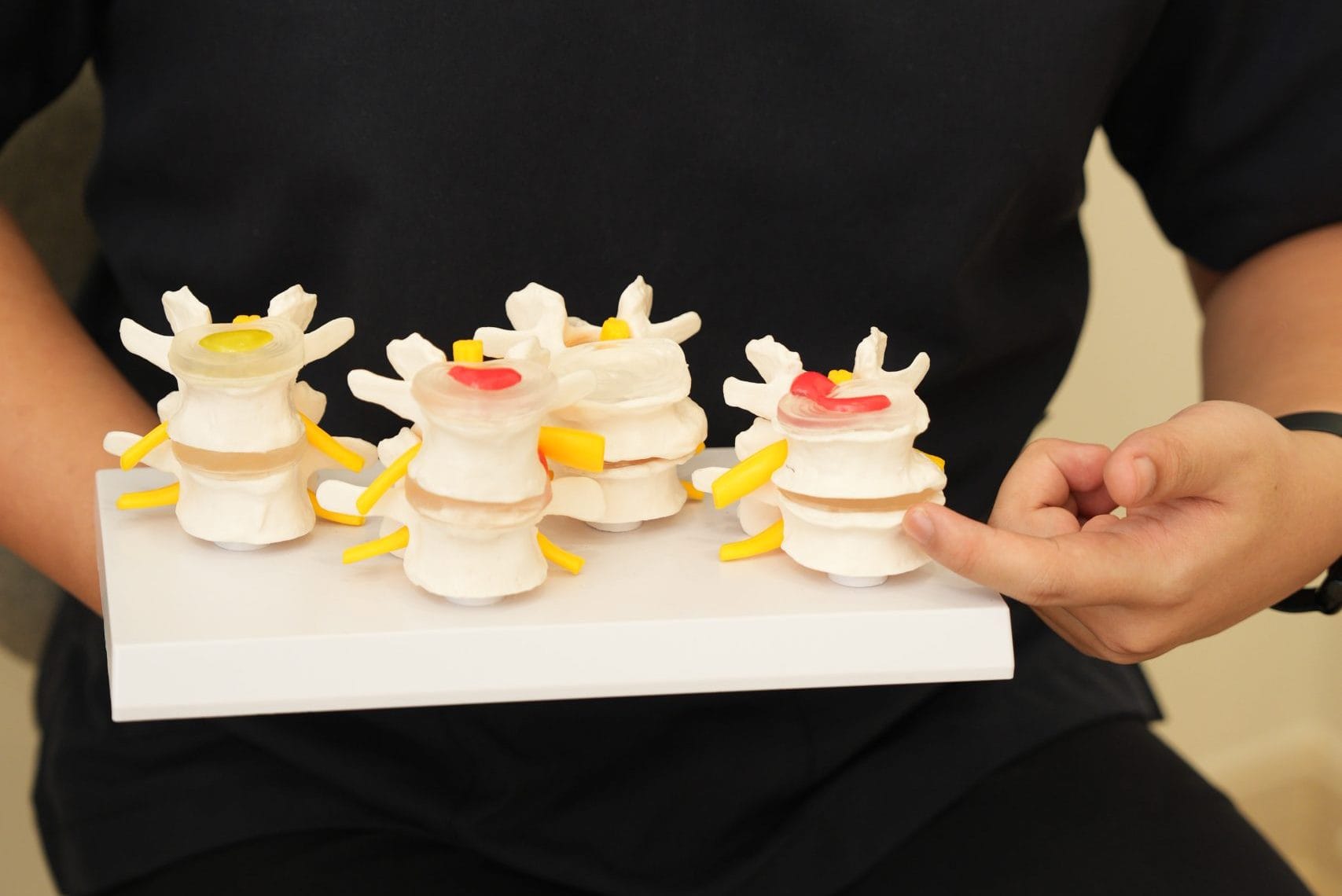 Spinal degeneration model