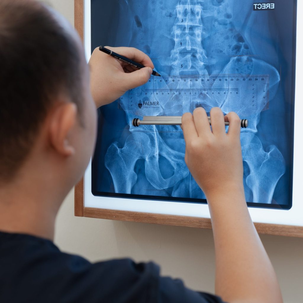 Rong Han is making x-ray analysis